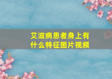 艾滋病患者身上有什么特征图片视频